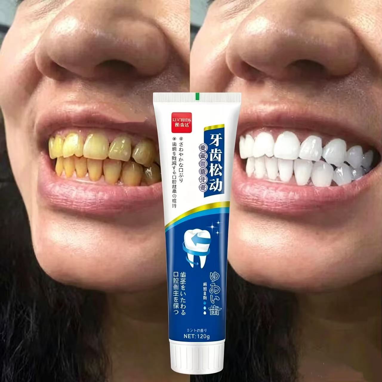 Teeth Whitening Japan - Dentifrice Japonais Importé pour Dents Dégarnies