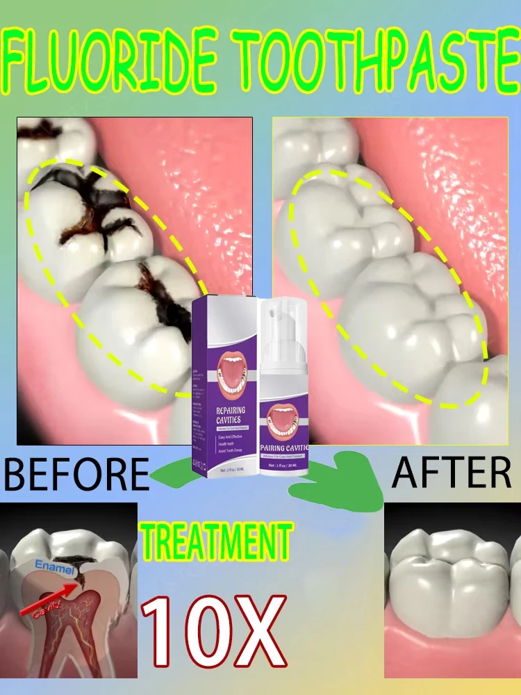 Teeth Whitening Products - Répare les cavités scientifiques, Élimine les