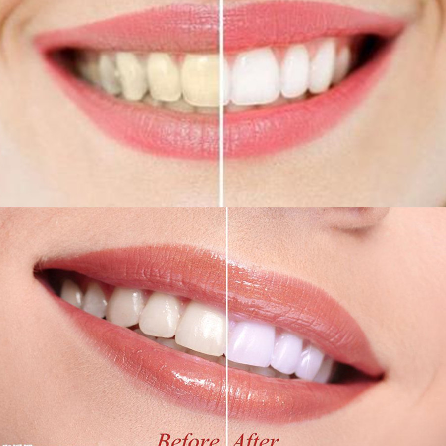 Poudre de charbon de bambou po - Teeth Whitening Near Me avis et prix