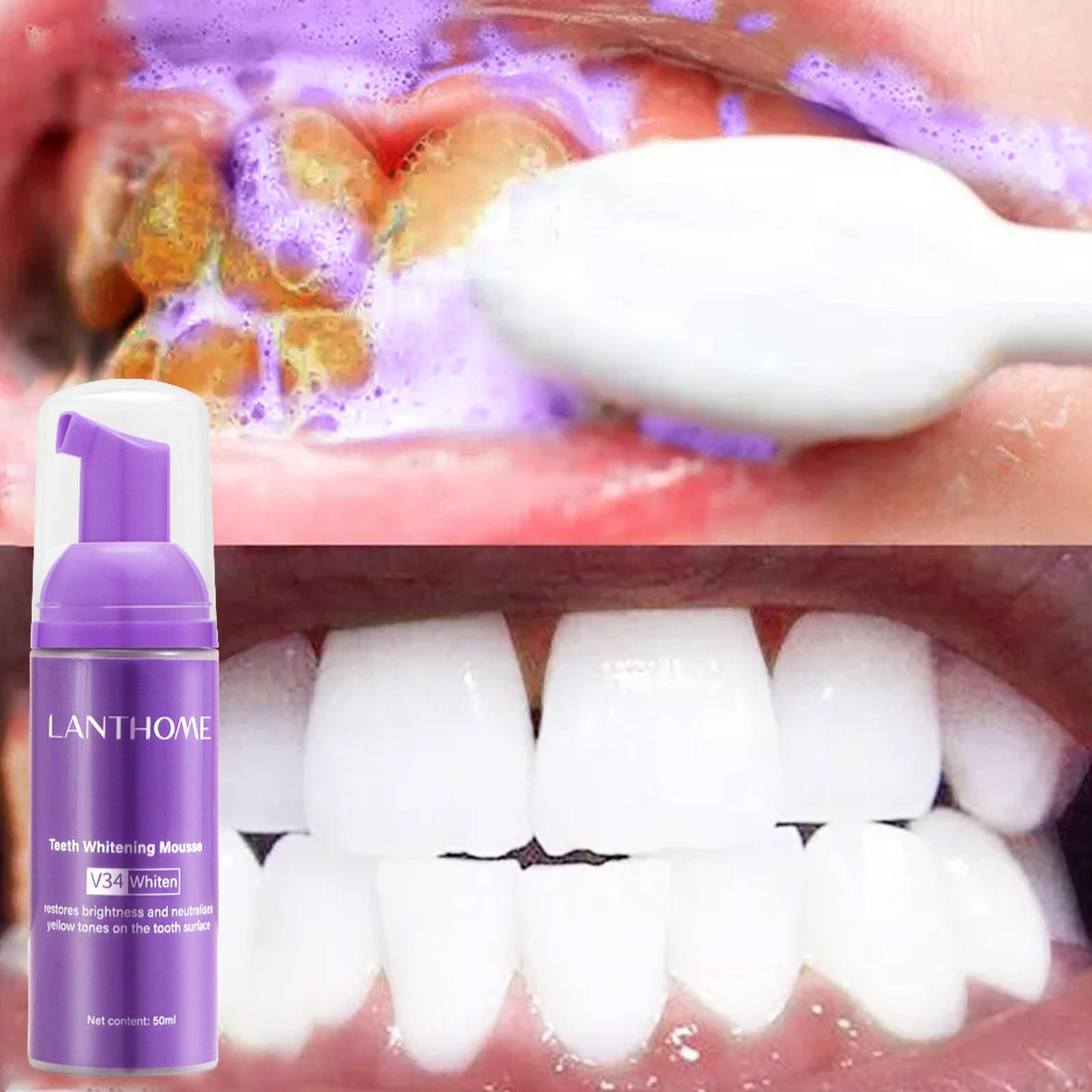 Mousse de blanchiment des dent - Teeth Whitening Foam Toothpaste avis et prix