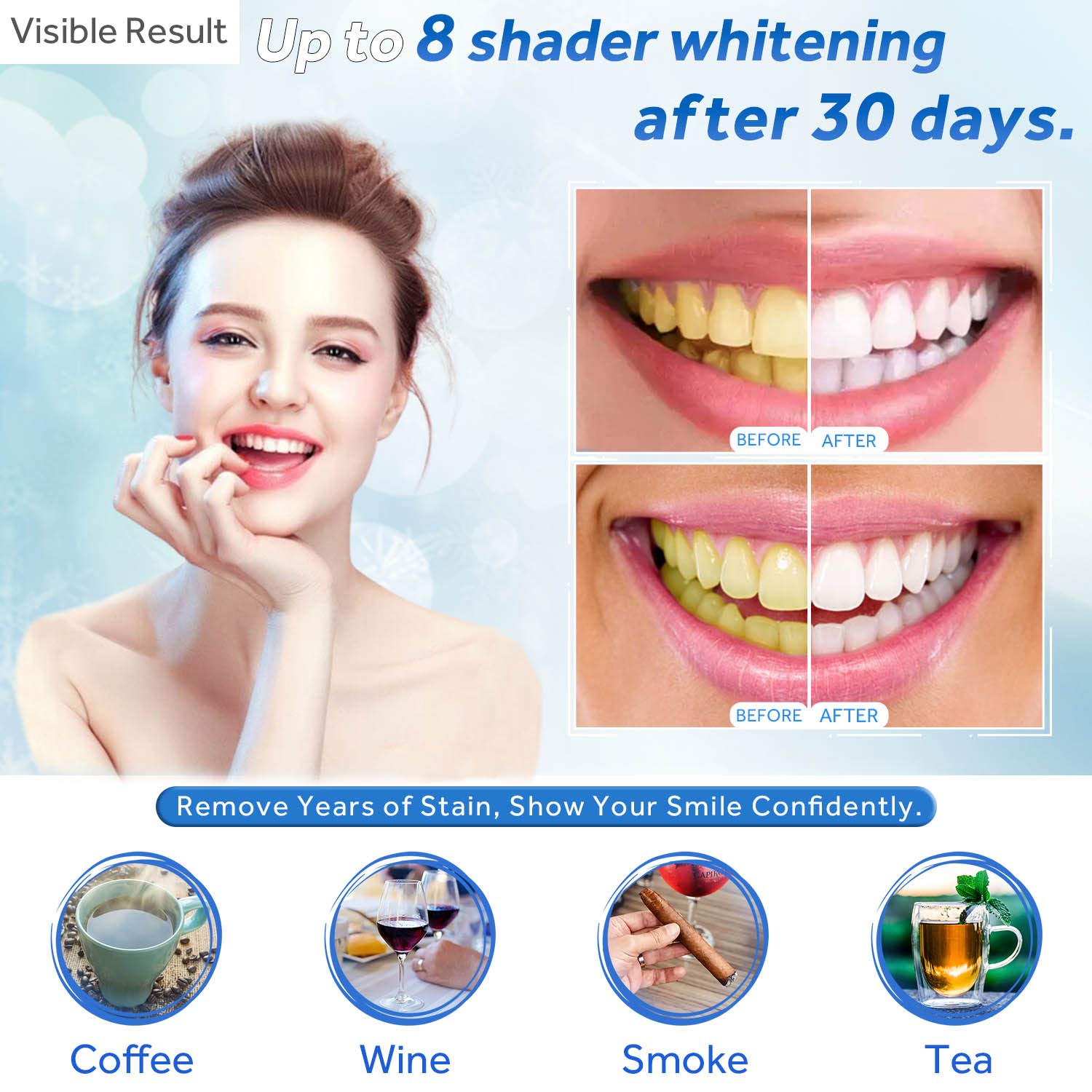 Gel de blanchiment des dents r - Teeth Whitening Clinic avis et prix