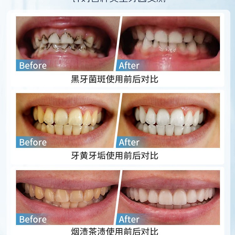 Brosse manuelle japonaise pour - Teeth Whitening Japan avis et prix