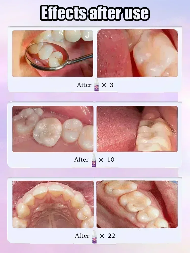 Répare les cavités scientifiqu - Teeth Whitening Products avis et prix