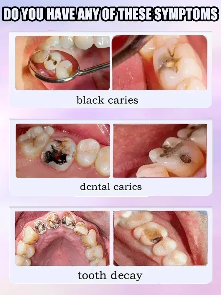 Répare les cavités scientifiqu - Teeth Whitening Products avis et prix