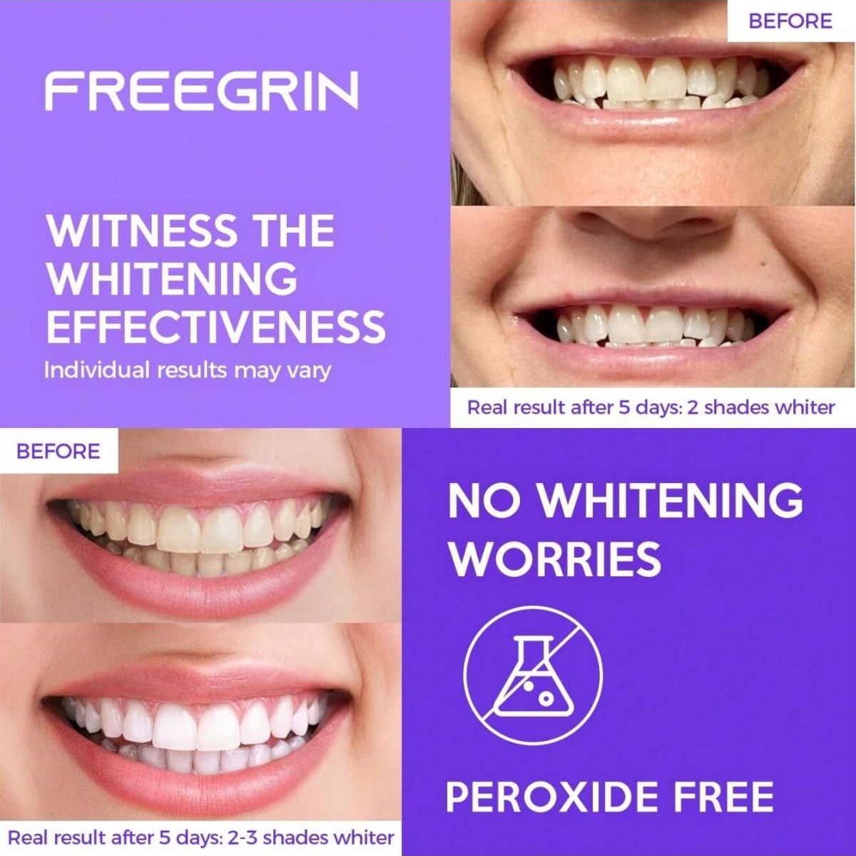 Autocollants de blanchiment de - Teeth Whitening Near Me avis et prix